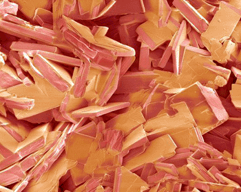 Image: Colored scanning electron micrograph (SEM) of the crystalline surface of a freeze-fractured gallstone (Photo courtesy of Steve Gschmeissner / SPL). Image: Colored scanning electron micrograph (SEM) of the crystalline surface of a freeze-fractured gallstone (Photo courtesy of Steve Gschmeissner / SPL).